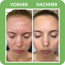 Lade das Bild in den Galerie-Viewer, GROOVD™ - Kinderkopfkissen für schnelleres Einschlafen
